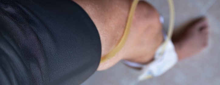 A catheter line strapped to a person's leg